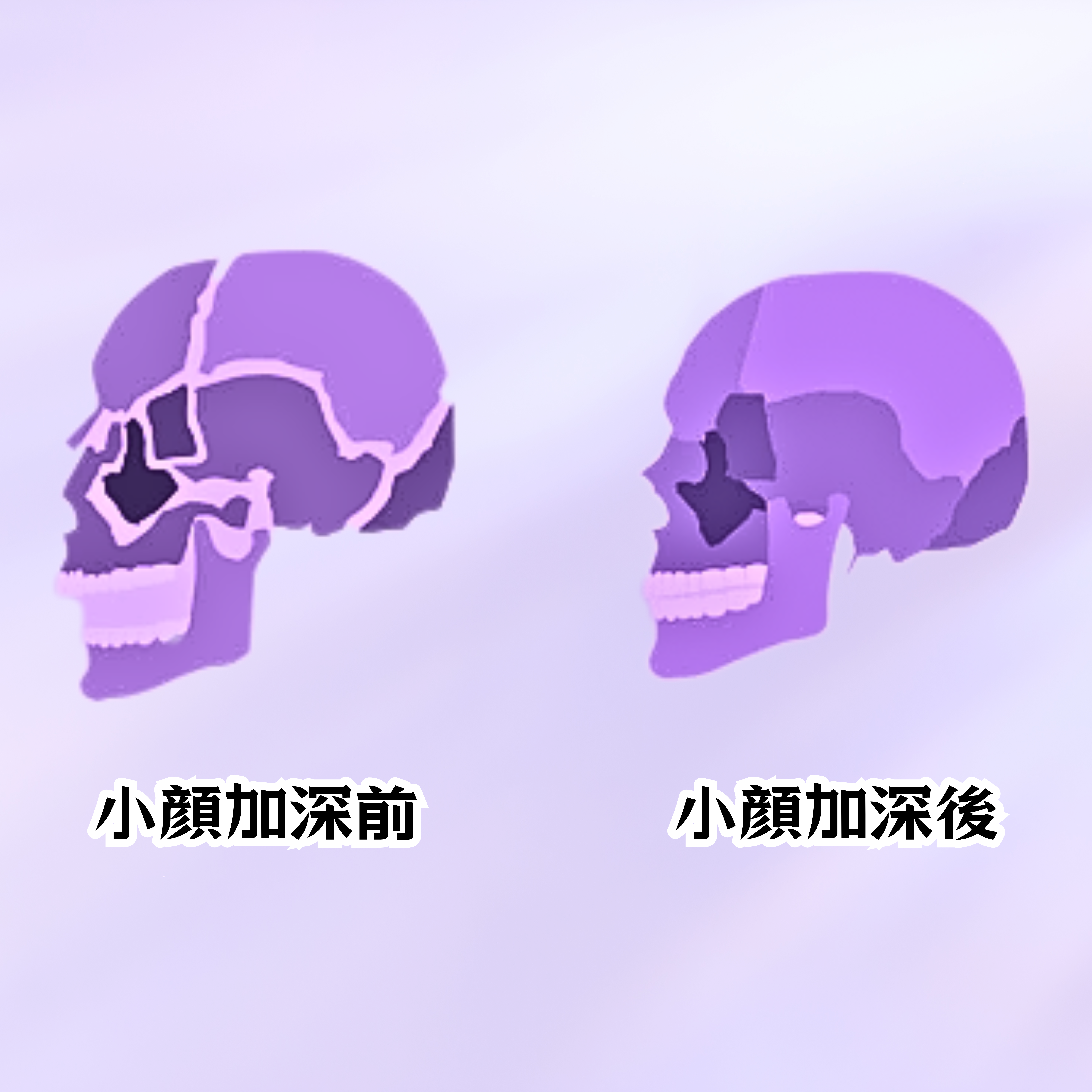 插圖並排比較了兩個紫色頭骨，每個頭骨下面都有日文文字，描述了之前和之後的狀態。.