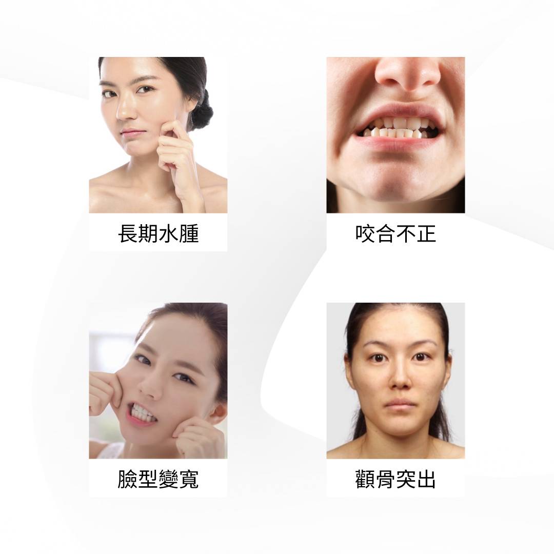 四幅圖像展示了不同的面部表情和特徵，每張圖片下方都有中文文字標籤。.