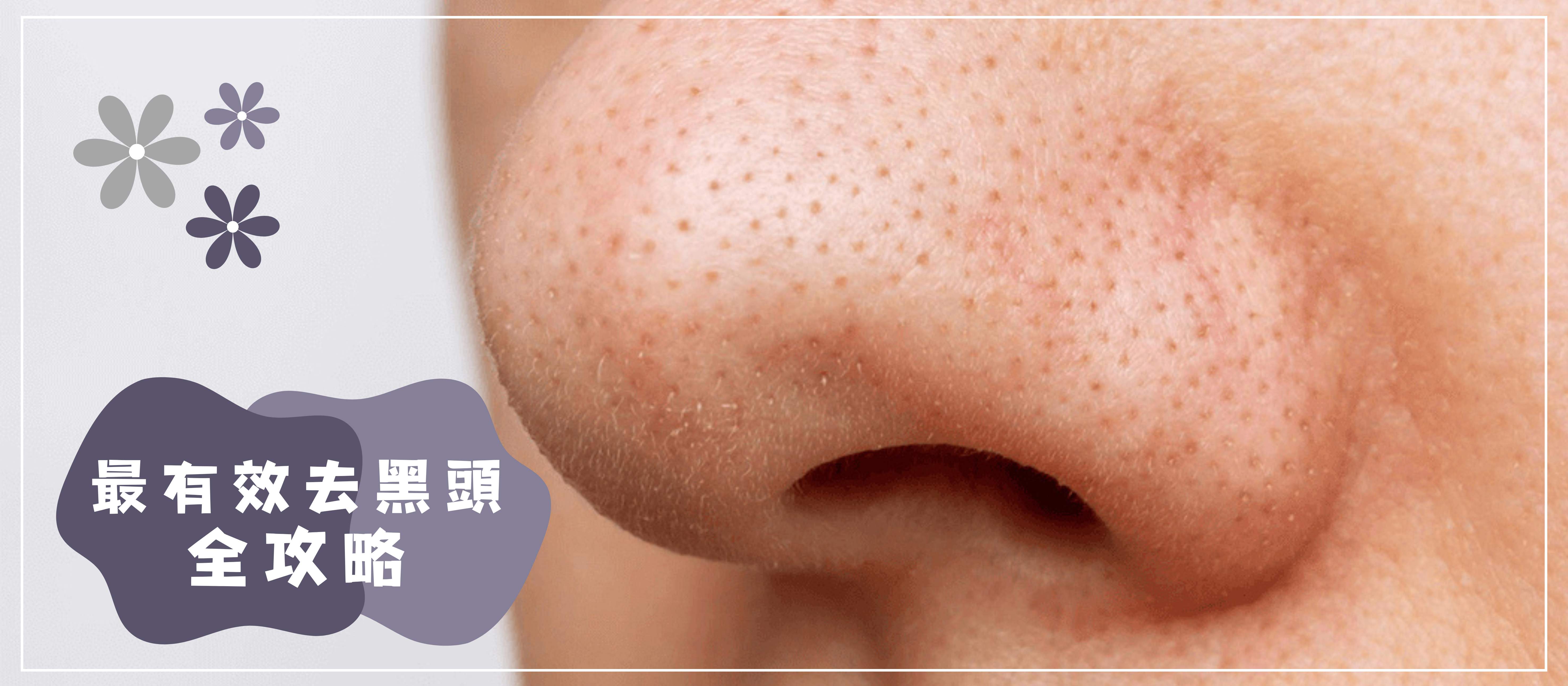 特寫鏡頭：人的鼻子，黑頭清晰可見，裝飾元素上有中文文字。.