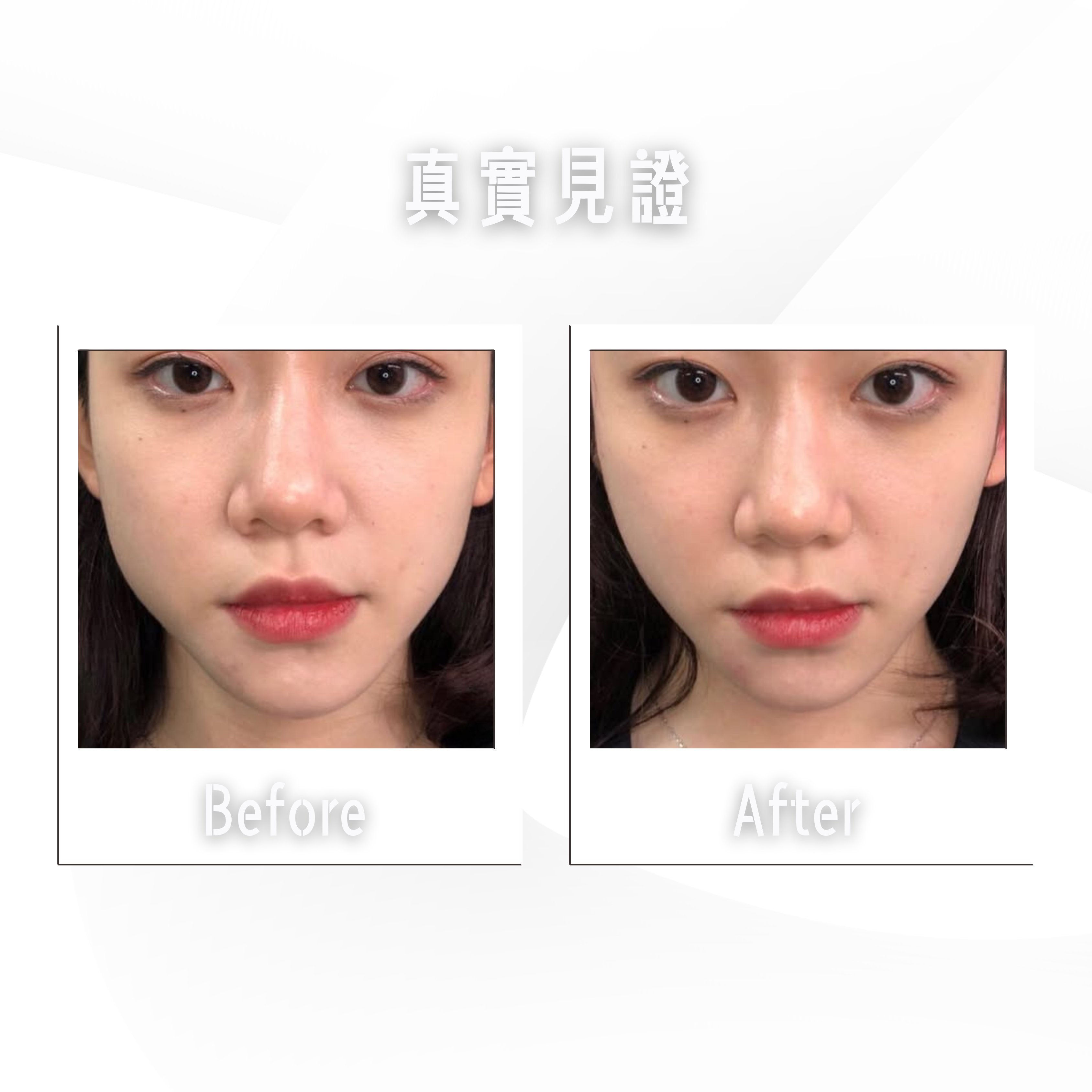 5 對比前後女性臉部,發現細微的差別。.